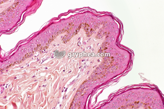 Peau race noire CT x70 - gryphea.org